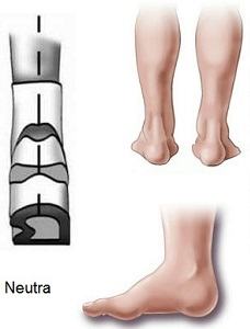 Pisada Neutra