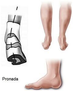 Pisada Pronada